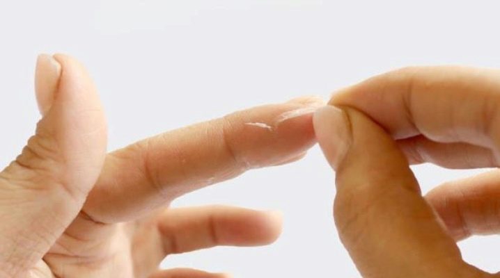 Чем очистить пальцы от суперклея: все способы